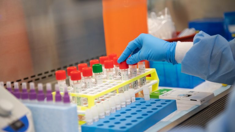 नवलपरासीमा थप ३९ जनामा कोरोना संक्रमण